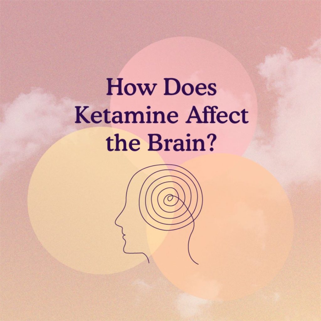 Comment la kétamine affecte-t-elle le cerveau ? Couverture de l'article de blog